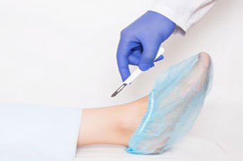 Foot surgery treatment in the New York County: Midtown Manhattan NY (Murray Hill, Rose Hill, Kips Bay, Nomad, Gramercy Park, Peter Cooper Village, Midtown East, West Village, Chelsea, Garment District) and Kings County: Brooklyn, NY (Dumbo, Сobble Hill, Boerum Hill, Carroll Gardens, Brooklyn Heights, Clinton Hill, Columbia Street Waterfront District, Gowanus, Vinegar Hill, Park Slope) areas