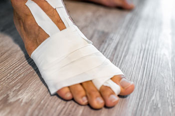 Foot Fractures treatment in the New York County: Midtown Manhattan NY (Murray Hill, Rose Hill, Kips Bay, Nomad, Gramercy Park, Peter Cooper Village, Midtown East, West Village, Chelsea, Garment District) and Kings County: Brooklyn, NY (Dumbo, Сobble Hill, Boerum Hill, Carroll Gardens, Brooklyn Heights, Clinton Hill, Columbia Street Waterfront District, Gowanus, Vinegar Hill, Park Slope) areas