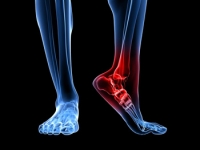 Possible Reasons Your Heel Hurts