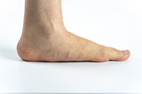 Possible Advantages for Flat-Footed People